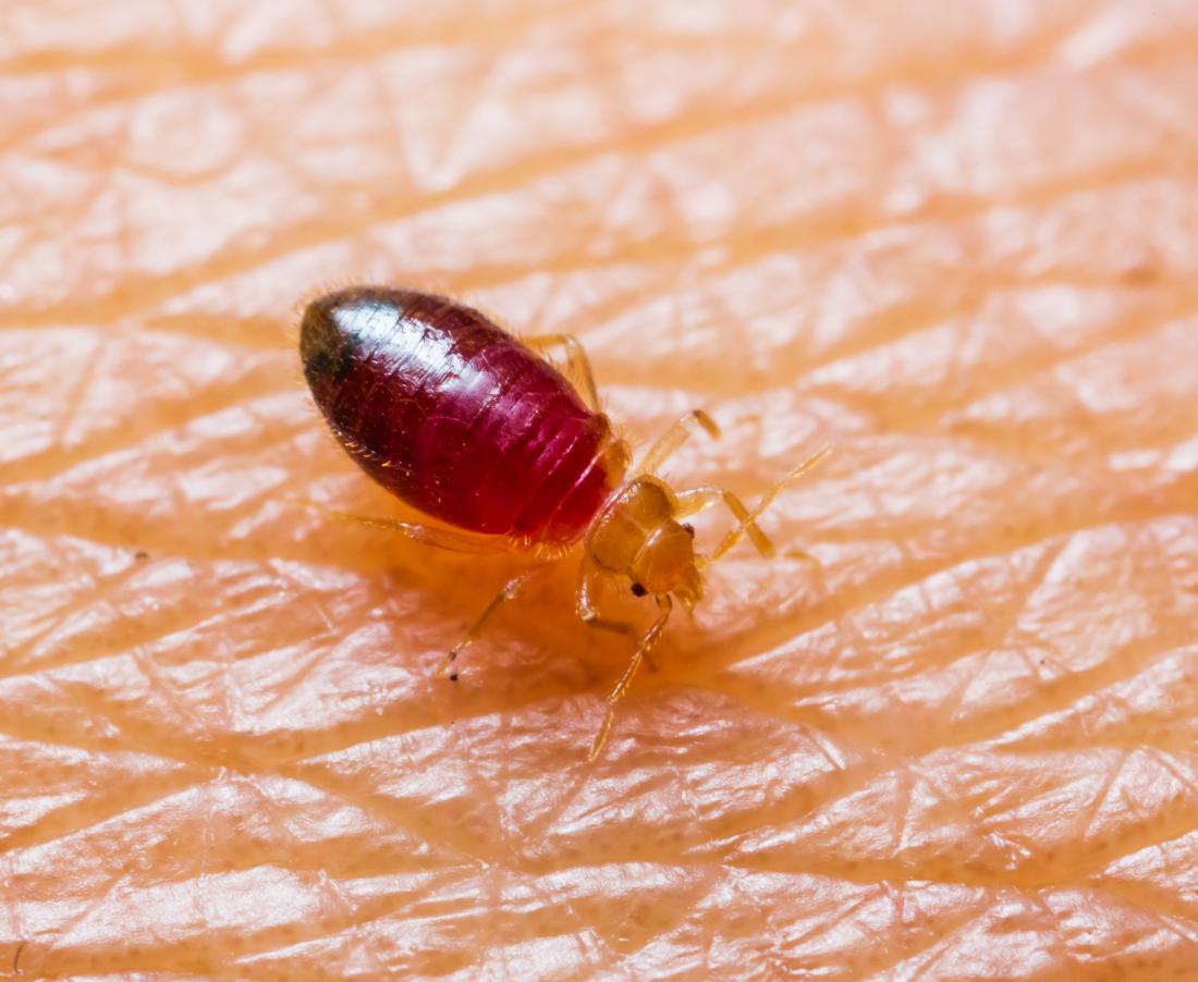 Chemical Options To Kill Fleas On Mattress