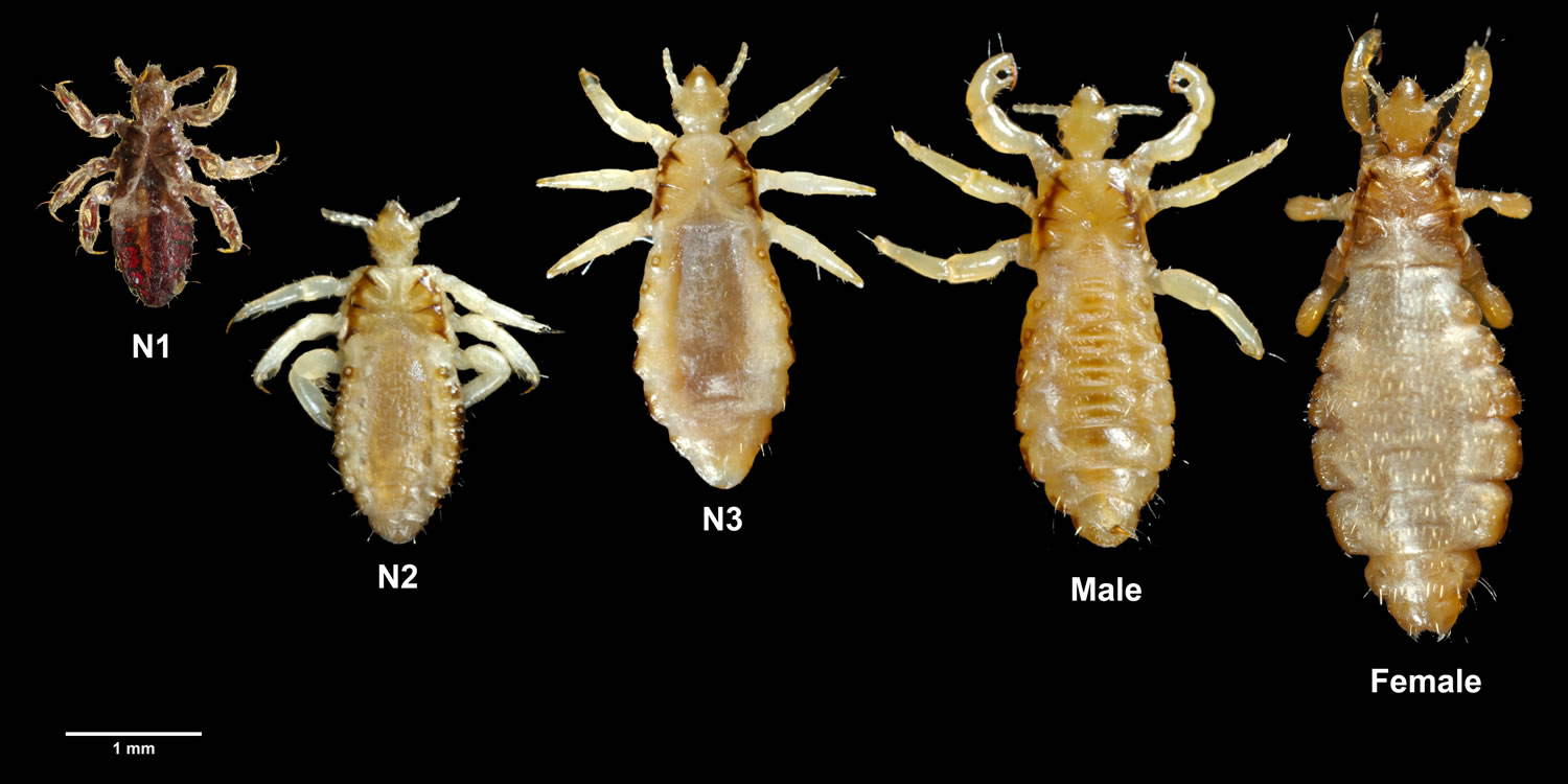How To Tell If Lice Have Been Cured